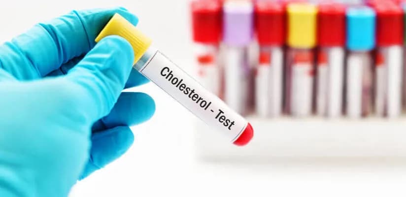 Czy stres podnosi cholesterol? Odkryj niebezpieczne skutki dla zdrowia